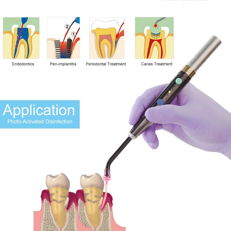 Wireless F3WW Dental Diode Las - Diode Laser Module recension och pris